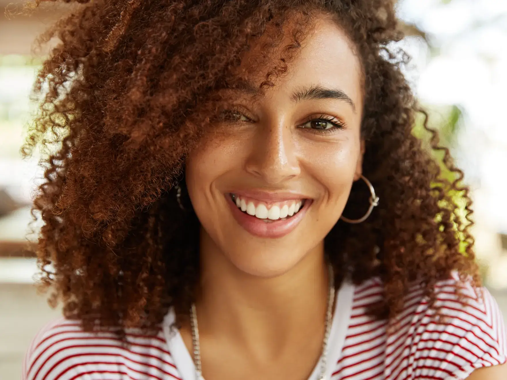 Teeth Whitening at Chesterfield Woodlake Dental